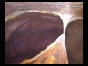 ADHESIONS BOWELS OMENTAL13 ADHESIONS BOWELS OMENTAL13
